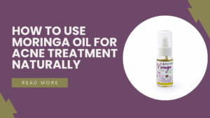 How to Use Moringa Oil for Acne Treatment Naturally